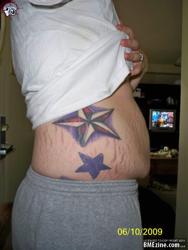 tatouage omoplate déformation