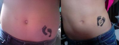 Tatouage pieds noirs