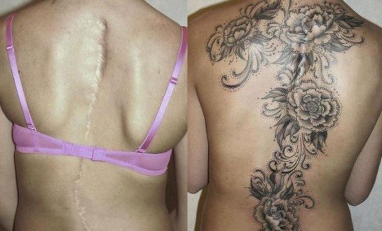tatouage ventre cesarienne