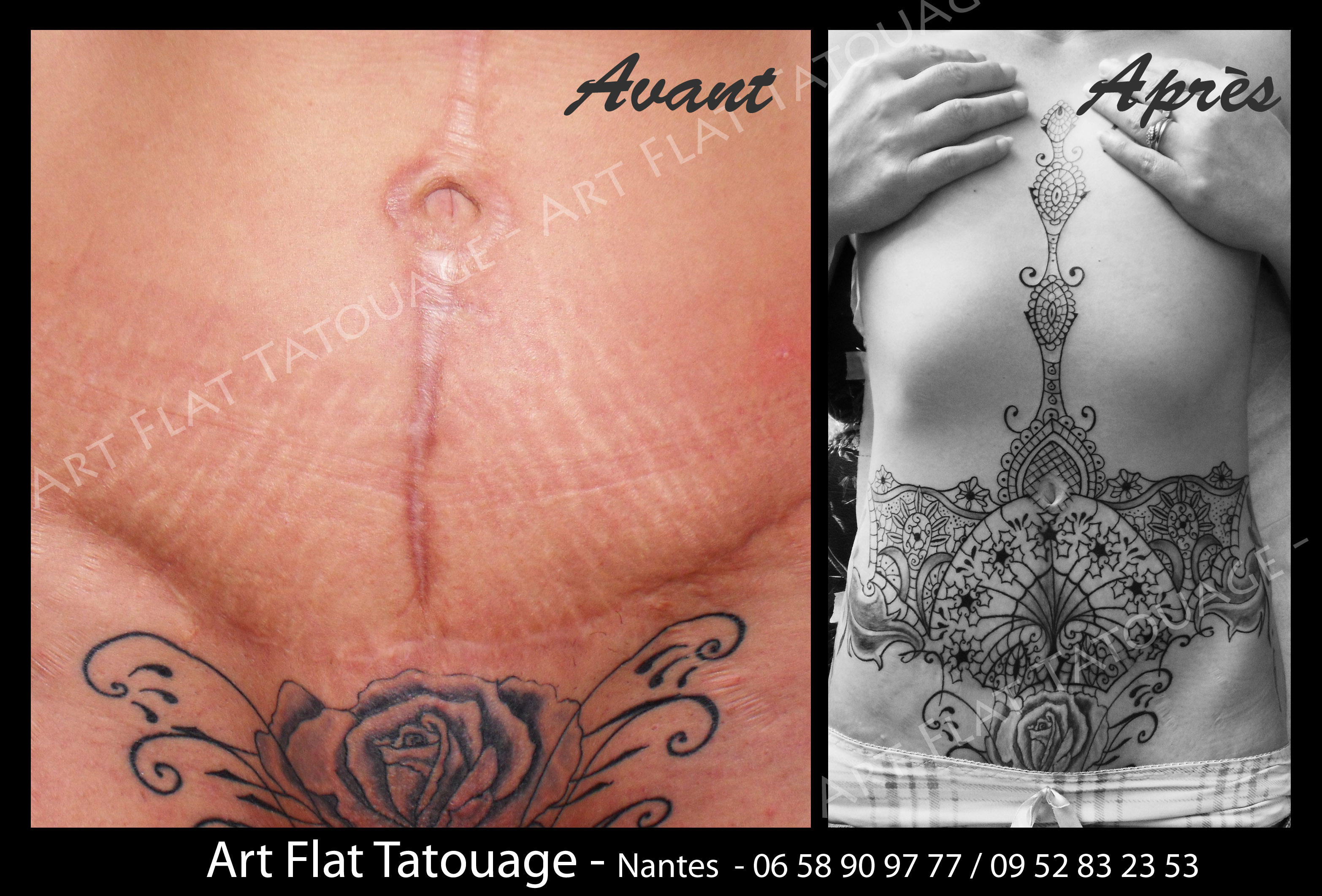 tatouage ventre cicatrisation